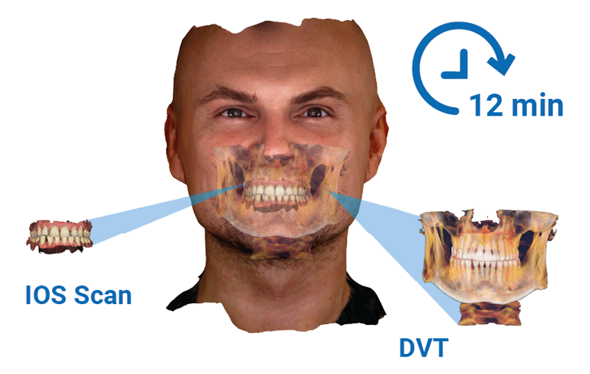 Gesichtsscann mit Röntgenaufnahme und Intraoralscann